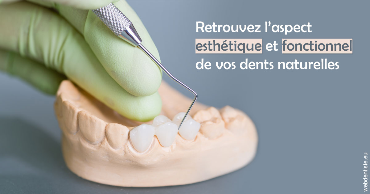 https://www.ortho-brunet.fr/Restaurations dentaires 1