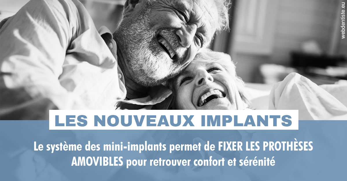 https://www.ortho-brunet.fr/Les nouveaux implants 2