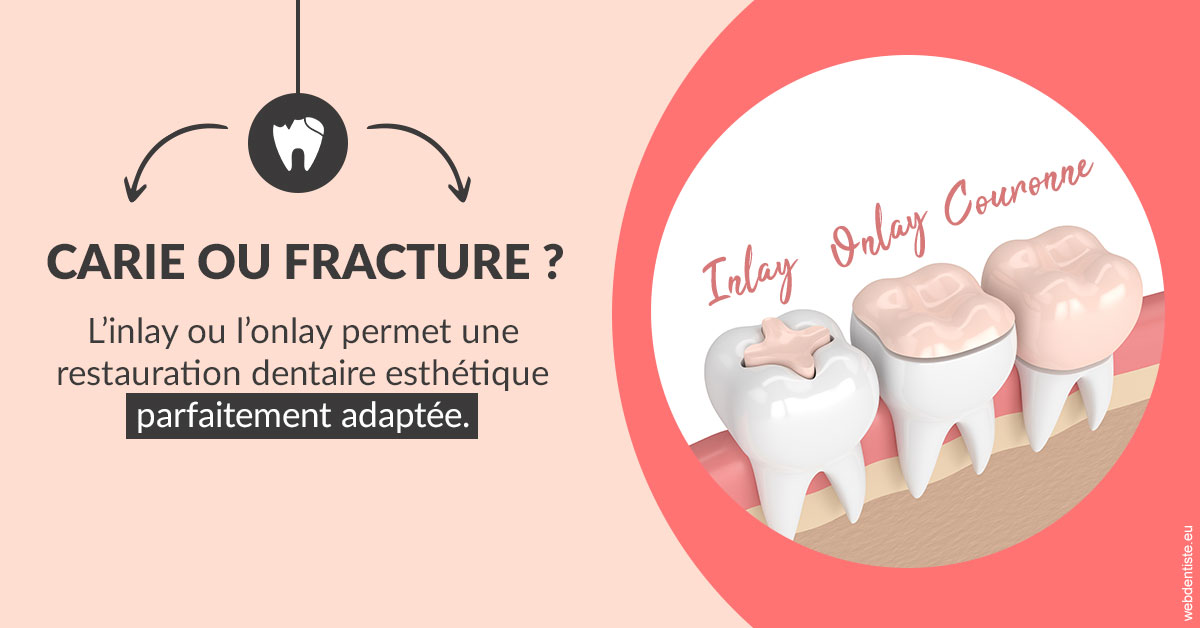 https://www.ortho-brunet.fr/T2 2023 - Carie ou fracture 2