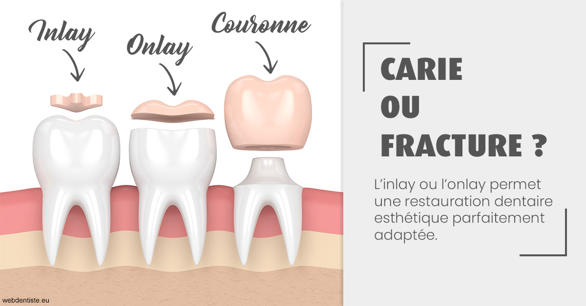 https://www.ortho-brunet.fr/T2 2023 - Carie ou fracture 1