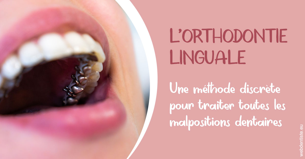 https://www.ortho-brunet.fr/L'orthodontie linguale 2