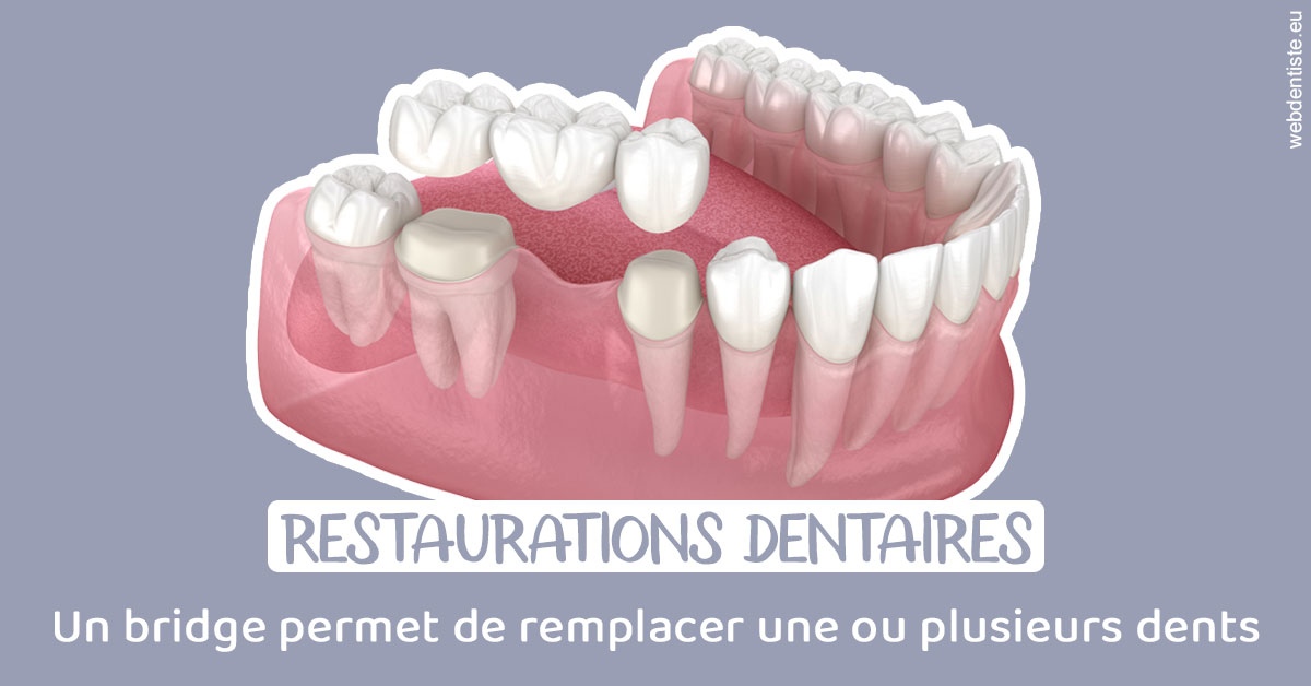 https://www.ortho-brunet.fr/Bridge remplacer dents 1