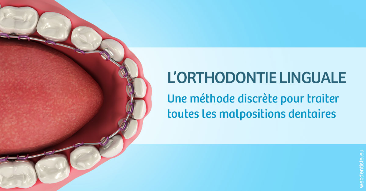 https://www.ortho-brunet.fr/L'orthodontie linguale 1