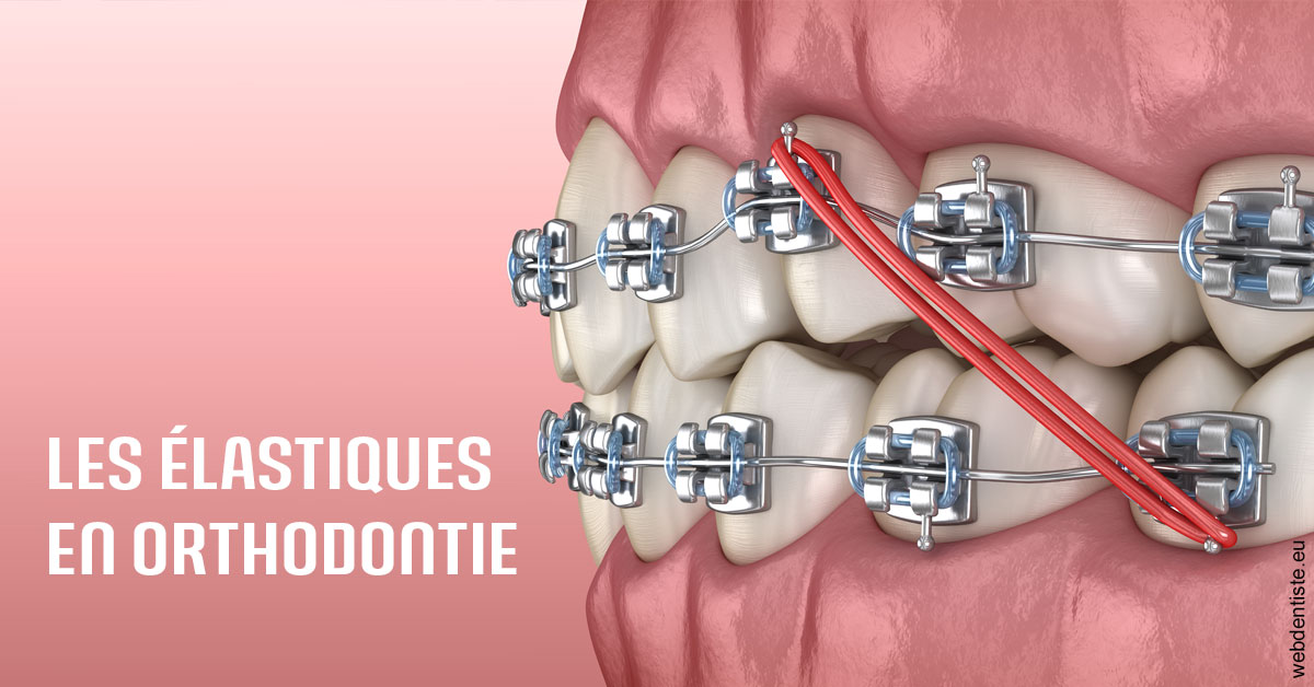 https://www.ortho-brunet.fr/Elastiques orthodontie 2