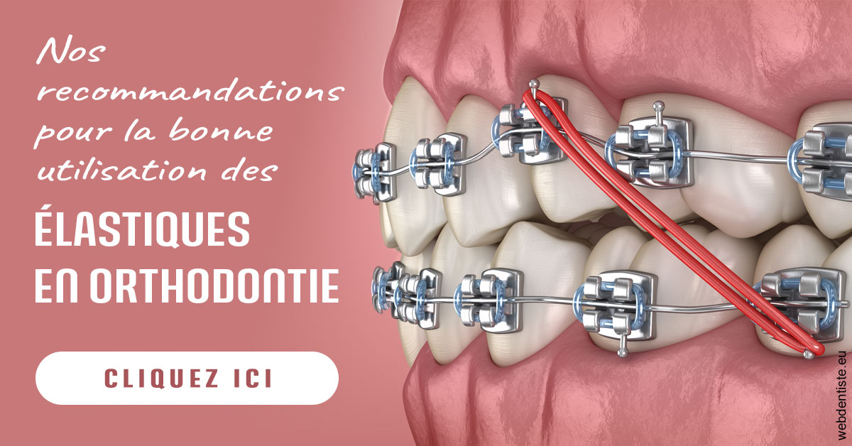 https://www.ortho-brunet.fr/Elastiques orthodontie 2